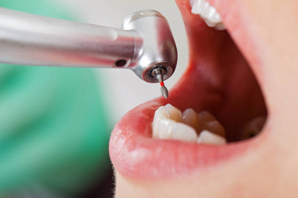 Best Mobile Emergency Dentist in Corcoran, CA